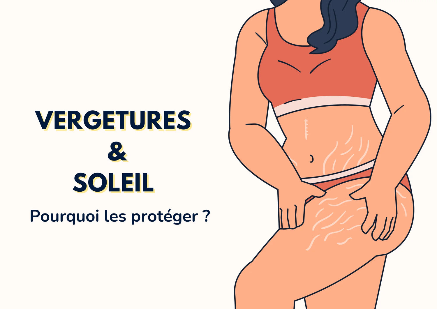 Protéger ses vergetures du soleil